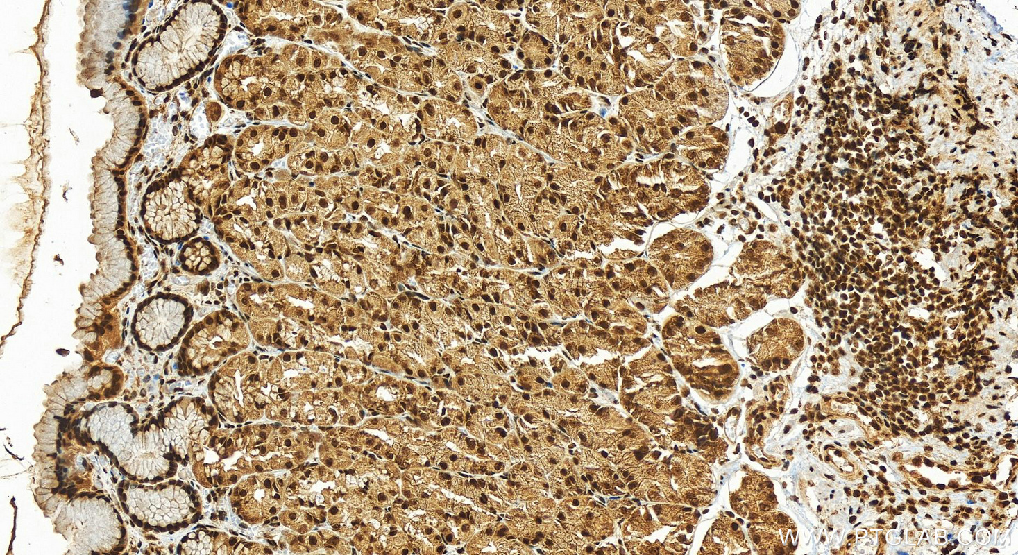 IHC staining of human stomach using 13066-1-AP