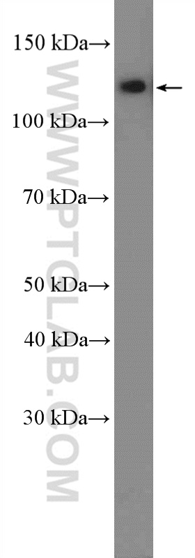 WB analysis of HeLa using 13066-1-AP