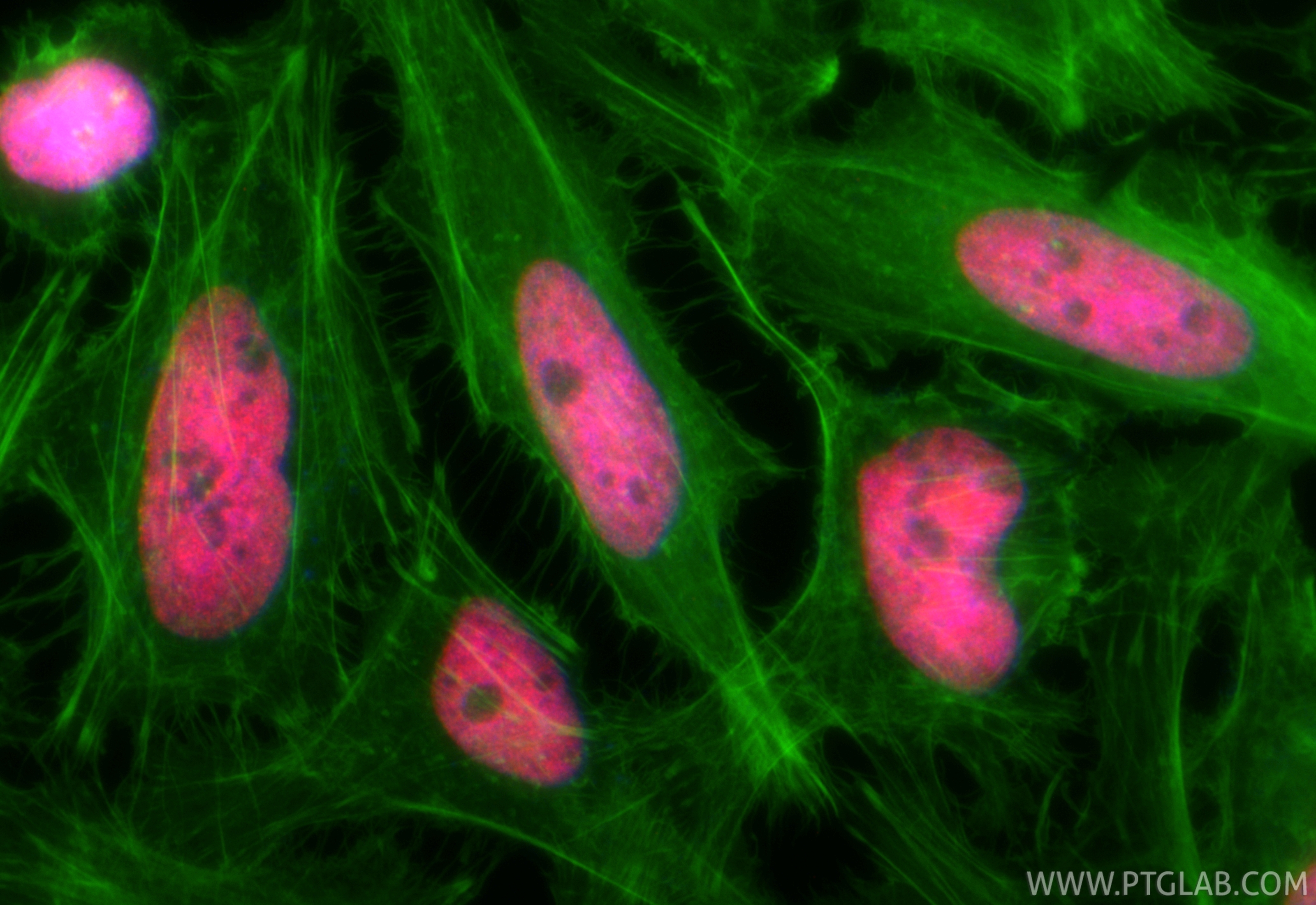 Immunofluorescent analysis of (4% PFA) fixed HeLa cells using CoraLite®594 SMARCA5 antibody (CL594-85019-3, Clone: 242512A8 ) at dilution of 1:200, CL488-Phalloidin (green). IF Staining of HeLa using CL594-85019-3