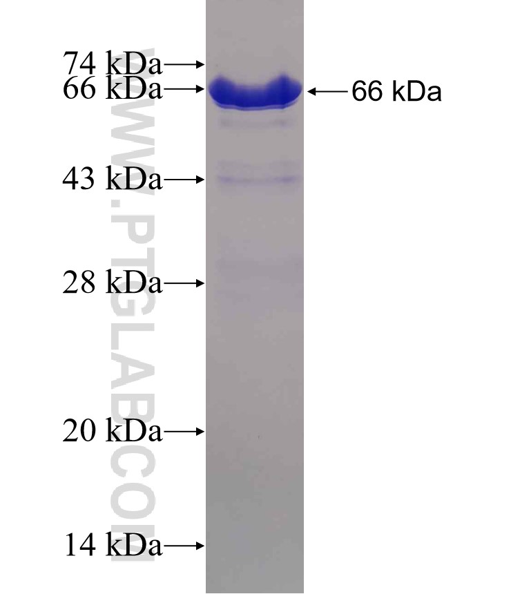 SMARCA5 fusion protein Ag3759 SDS-PAGE