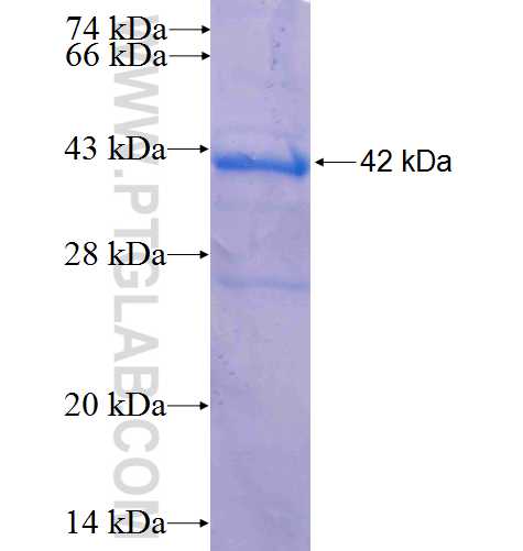 SMARCAD1 fusion protein Ag5281 SDS-PAGE SMARCAD1 fusion protein Ag5281 SDS-PAGE