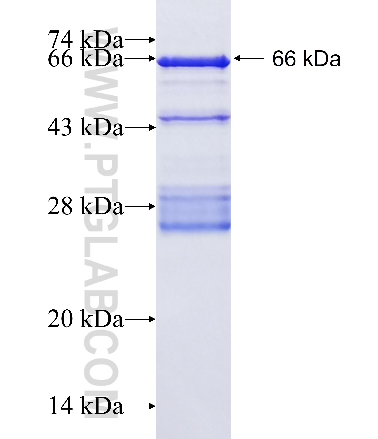 SMARCAL1 fusion protein Ag3194 SDS-PAGE