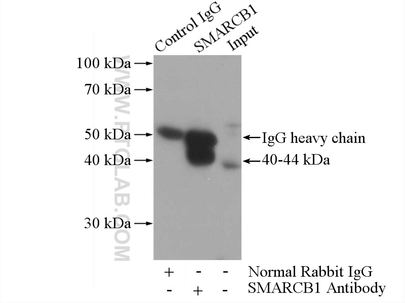 IP experiment of K-562 using 20654-1-AP