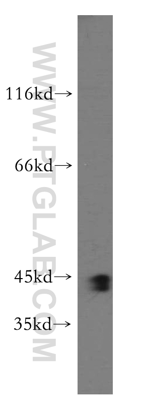 SMARCB1 Polyclonal antibody