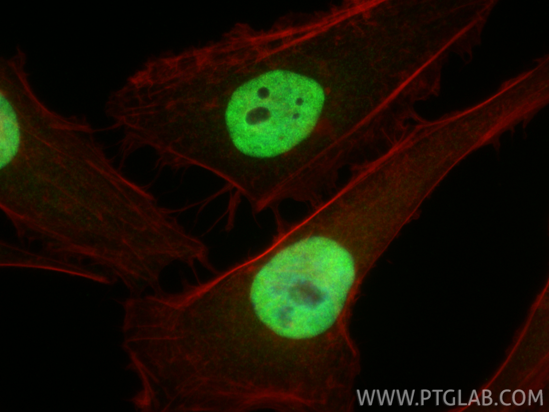 IF Staining of HeLa using 17722-1-AP