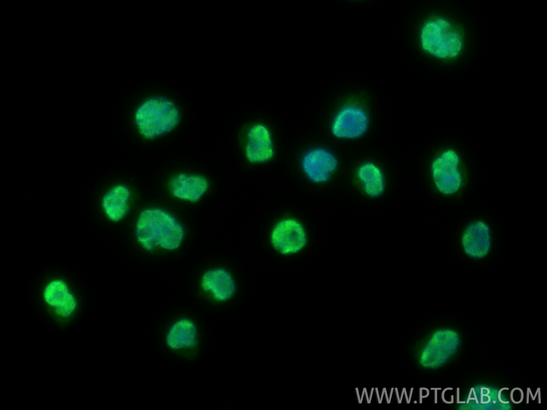 IF Staining of Jurkat using 17722-1-AP