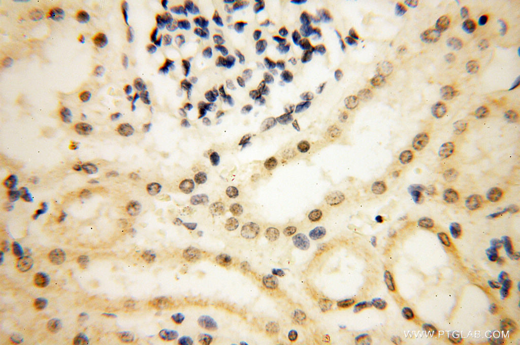 IHC staining of human kidney using 17722-1-AP