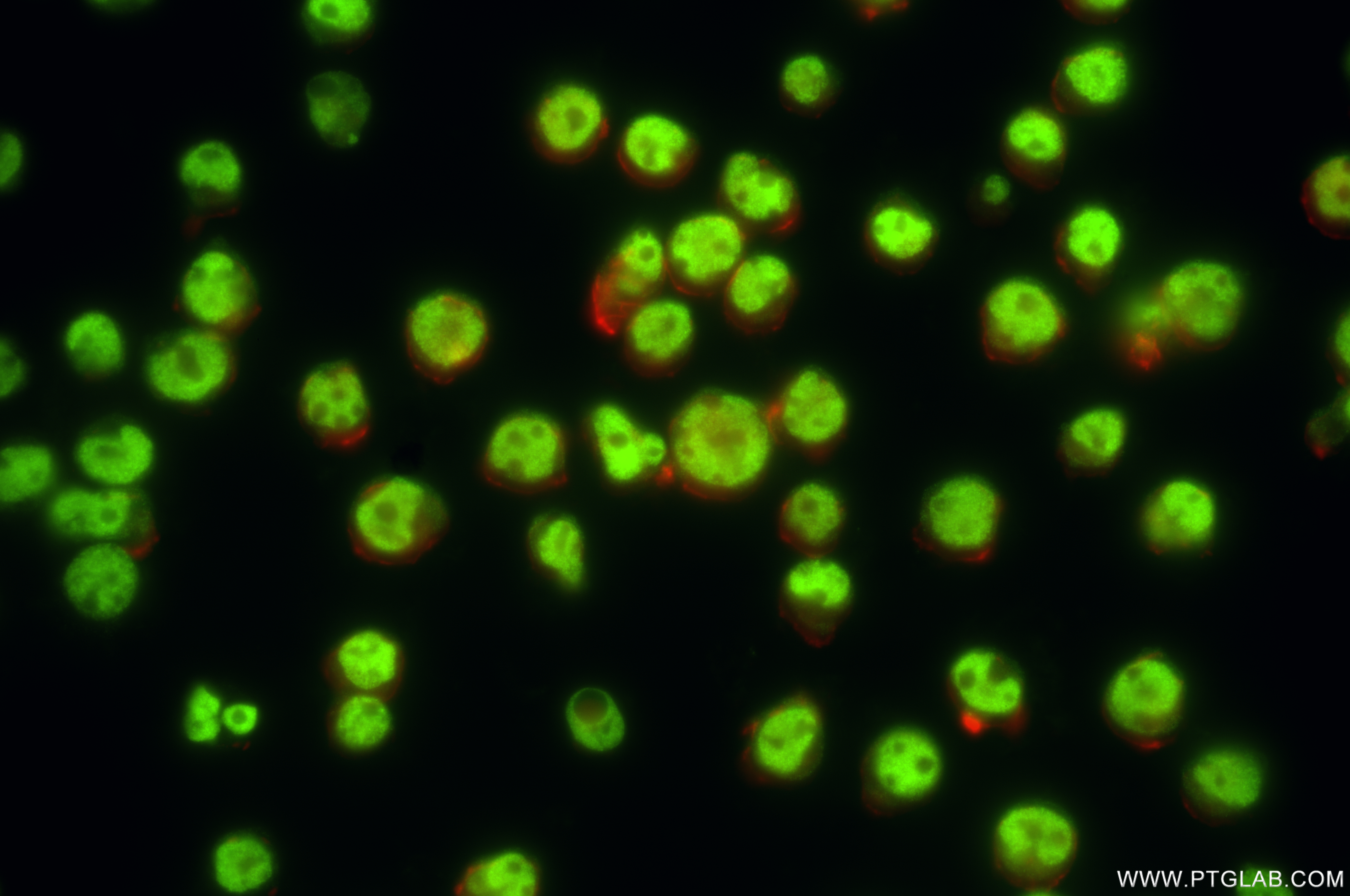 IF Staining of Jurkat using 86015-1-RR (same clone as 86015-1-PBS)