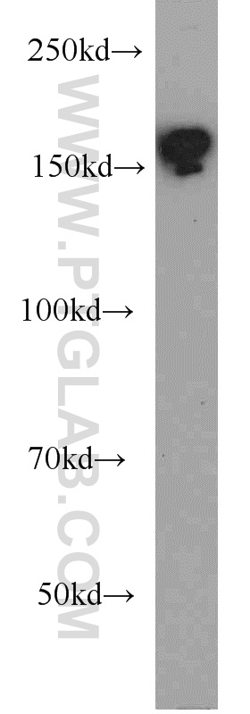 BAF170 Polyclonal antibody