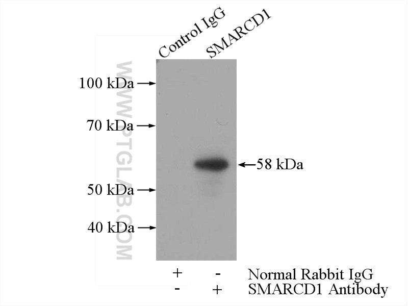 IP experiment of mouse brain using 10998-2-AP