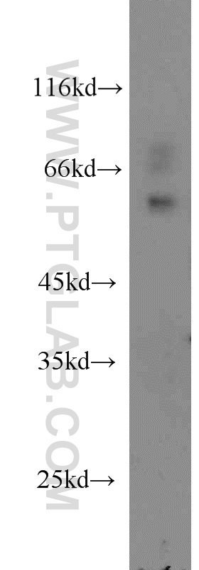 WB analysis of RAW264.7 using 11156-1-AP