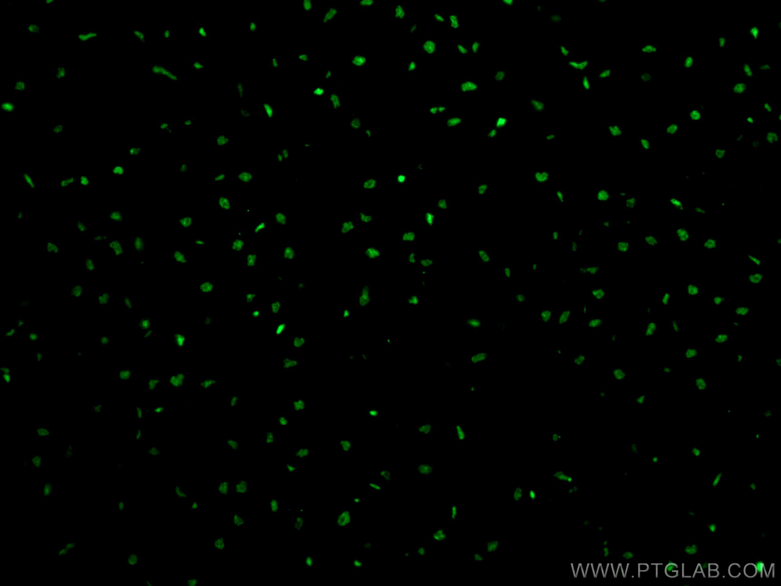 IF Staining of human heart using 12838-1-AP