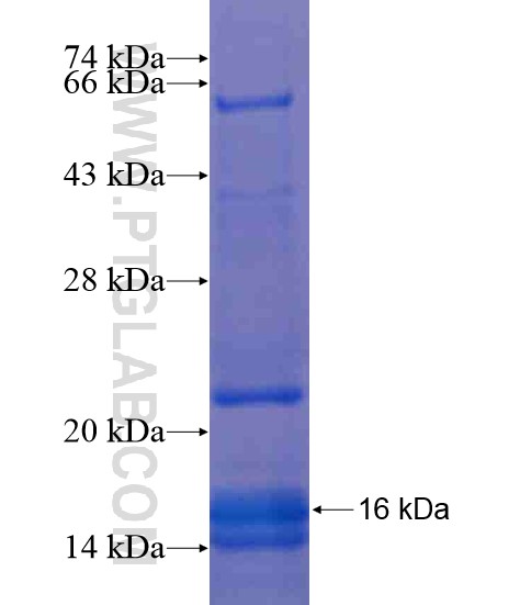 SMARCD3 fusion protein Ag19242 SDS-PAGE SMARCD3 fusion protein Ag19242 SDS-PAGE