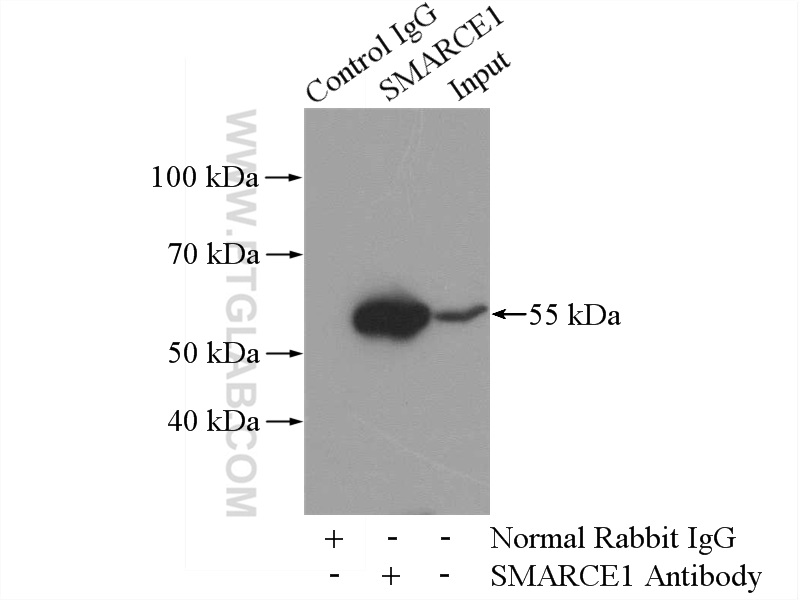 IP experiment of HEK-293 using 10814-1-AP