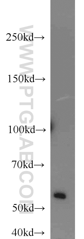 SMARCE1 Polyclonal antibody