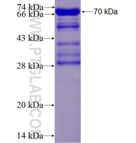 SMARCE1 fusion protein Ag1161 SDS-PAGE