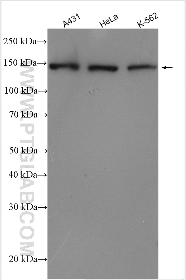 WB analysis using 21695-1-AP