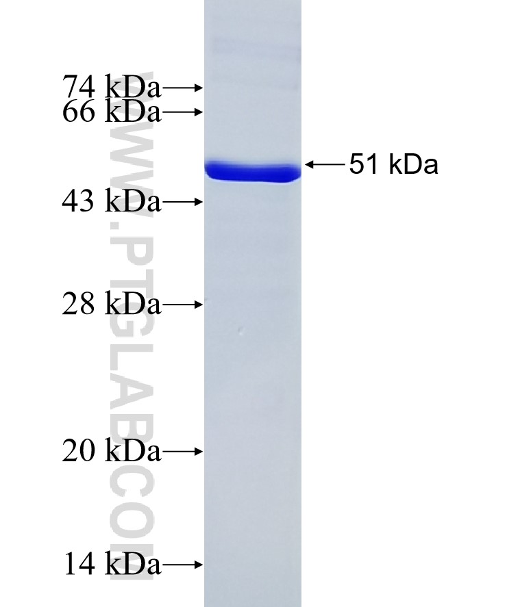 SMC1A fusion protein Ag17257 SDS-PAGE