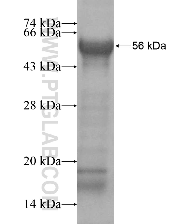 SMC1B fusion protein Ag17123 SDS-PAGE SMC1B fusion protein Ag17123 SDS-PAGE