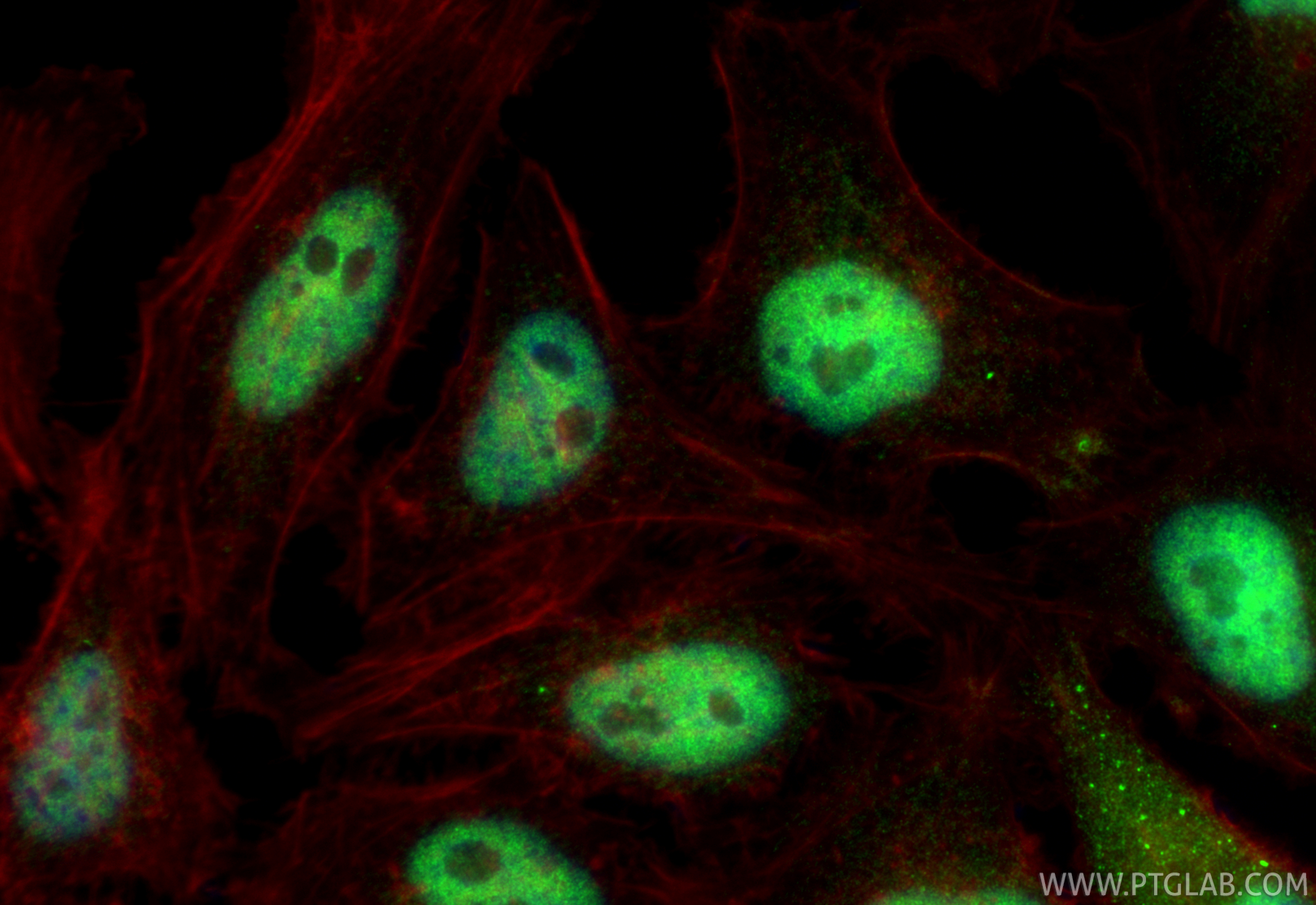 IF Staining of HeLa using 14185-1-AP (same clone as 14185-1-PBS) IF Staining of HeLa using 14185-1-AP (same clone as 14185-1-PBS)
