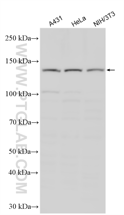 WB analysis using 14185-1-AP