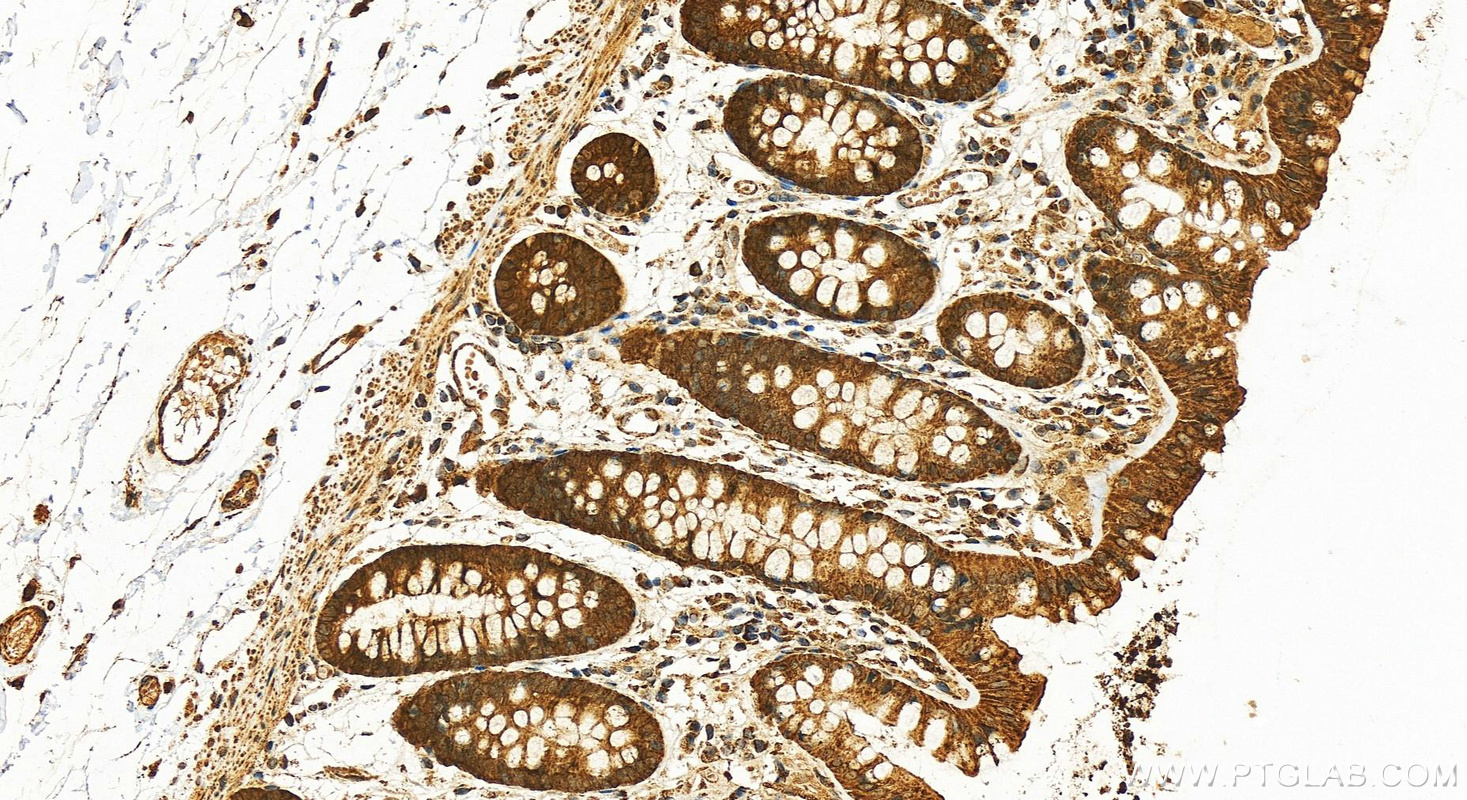 IHC staining of human colon using 24758-1-AP