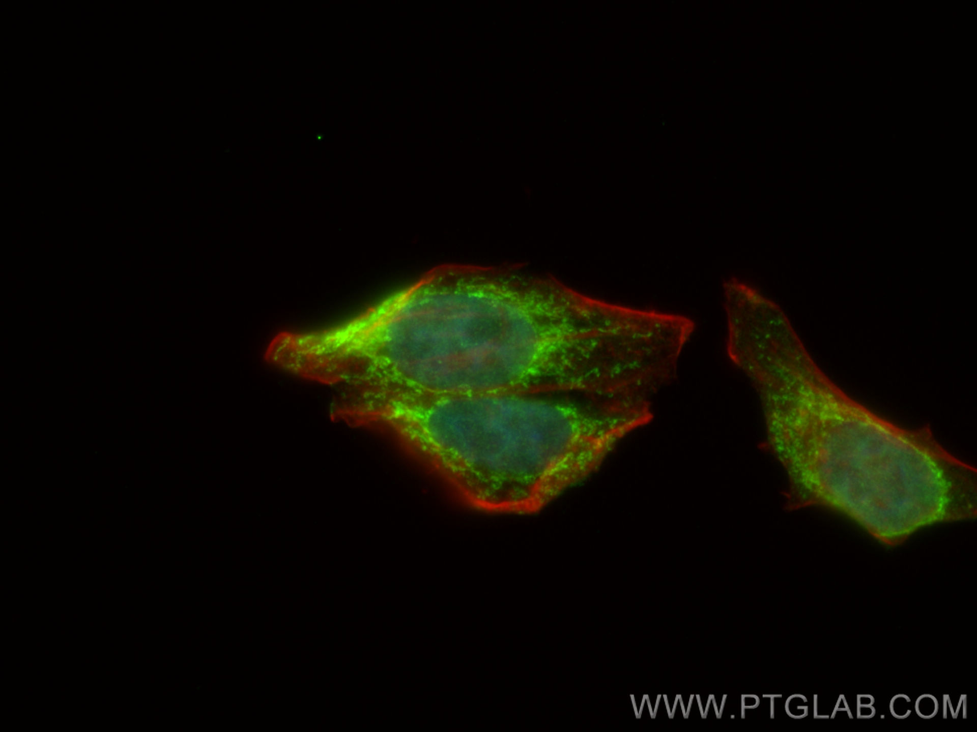 IF Staining of HepG2 using 24758-1-AP