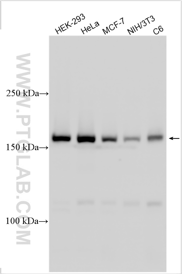 Various lysates were subjected to SDS PAGE followed by western blot with 24758-1-AP (SMC4 antibody) at dilution of 1:10000 incubated at room temperature for 1.5 hours. WB analysis using 24758-1-AP