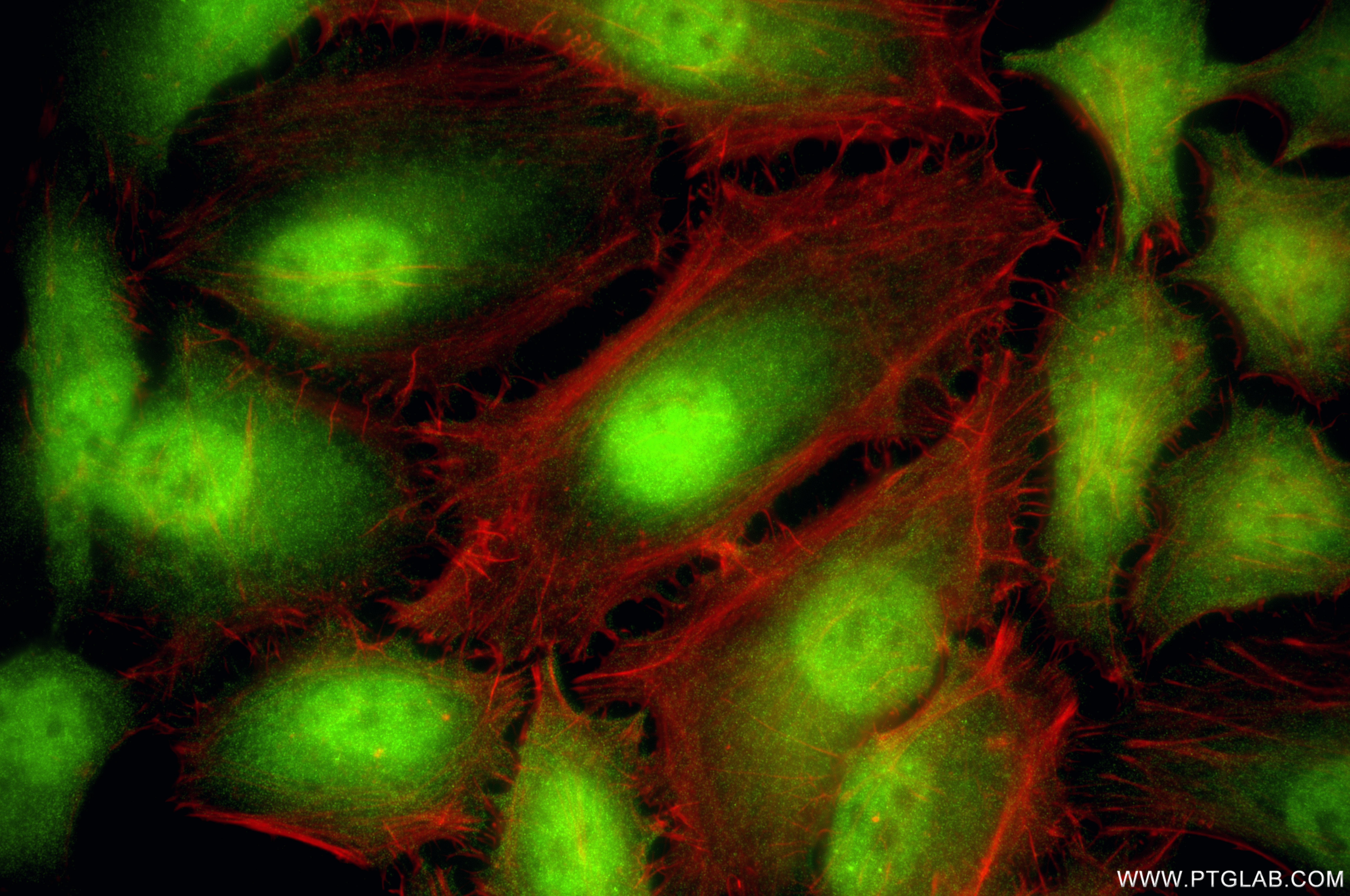 IF Staining of HeLa using 86182-1-RR