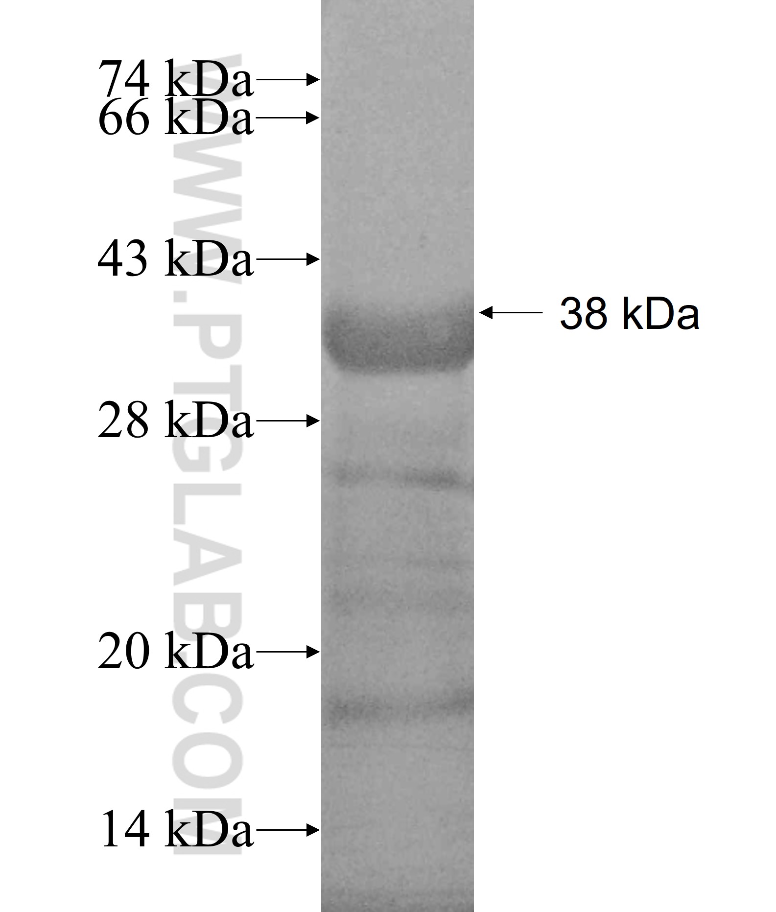 SMC4 fusion protein Ag19039 SDS-PAGE SMC4 fusion protein Ag19039 SDS-PAGE