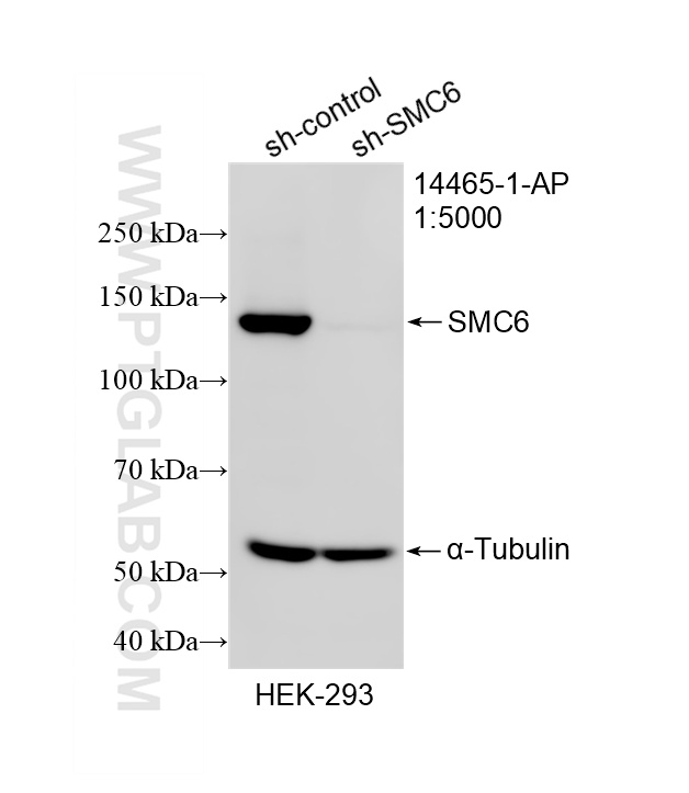 WB result of SMC6 antibody (14465-1-AP; 1:5000; incubated at room temperature for 1.5 hours) with sh-Control and sh-SMC6 transfected HEK-293 cells. WB analysis of HEK-293 using 14465-1-AP