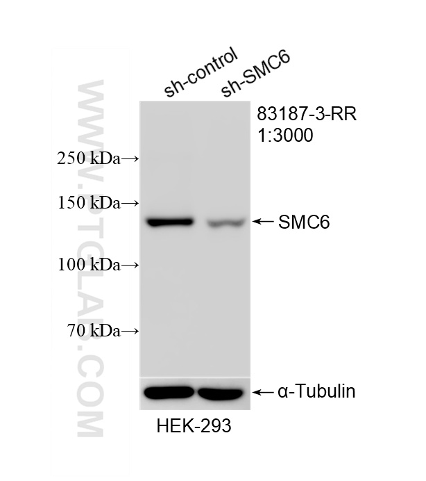 WB result of SMC6 antibody (<a class='green' href='/productredirect?CatalogNo=83187-3-RR' target='_blank'>83187-3-RR</a>; 1:3000; incubated at room temperature for 1.5 hours) with sh-Control and sh-SMC6 transfected HEK-293 cells. This data was developed using the same antibody clone with 83187-3-PBS in a different storage buffer formulation. WB analysis of HEK-293 using 83187-3-RR (same clone as 83187-3-PBS)