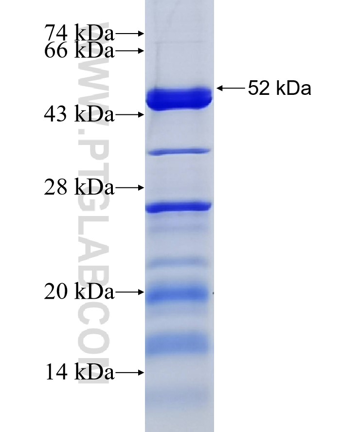 SMC6 fusion protein Ag6898 SDS-PAGE