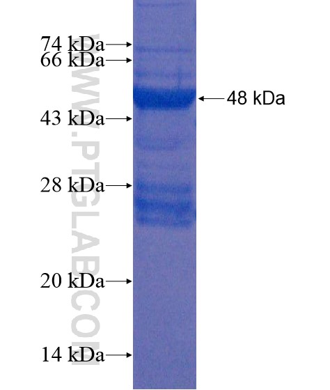 SMCHD1 fusion protein Ag22293 SDS-PAGE