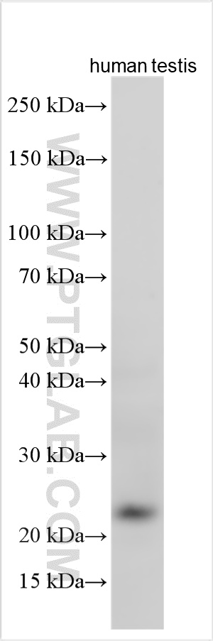 Various lysates were subjected to SDS PAGE followed by western blot with 13936-1-AP (SMCP antibody) at dilution of 1:4000 incubated at room temperature for 1.5 hours. WB analysis using 13936-1-AP