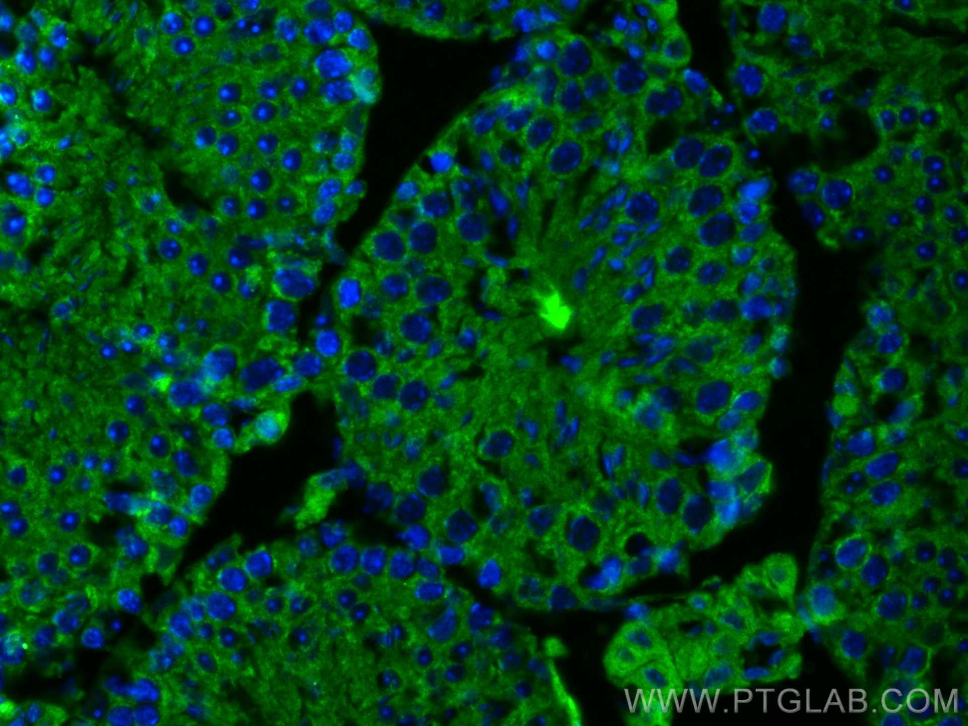 IF Staining of mouse testis using 67808-1-Ig (same clone as 67808-1-PBS)