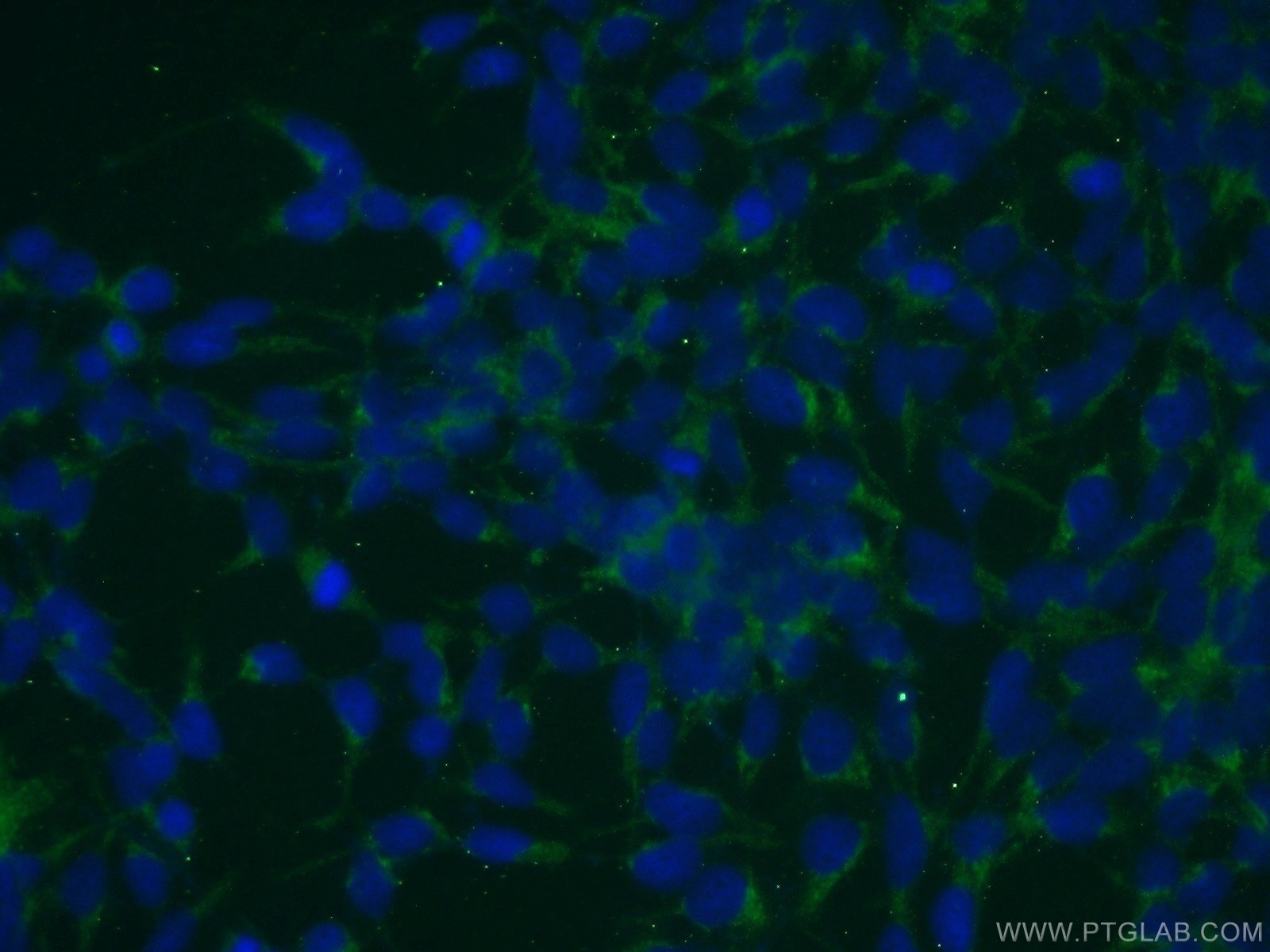 IF Staining of HEK-293 using 20348-1-AP