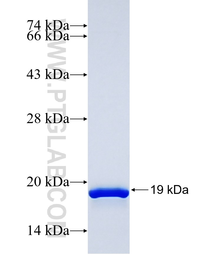 SMG6 fusion protein Ag34198 SDS-PAGE