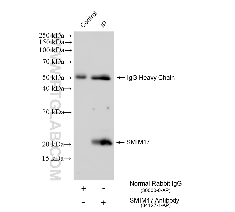 IP experiment of rat brain using 34127-1-AP IP experiment of rat brain using 34127-1-AP