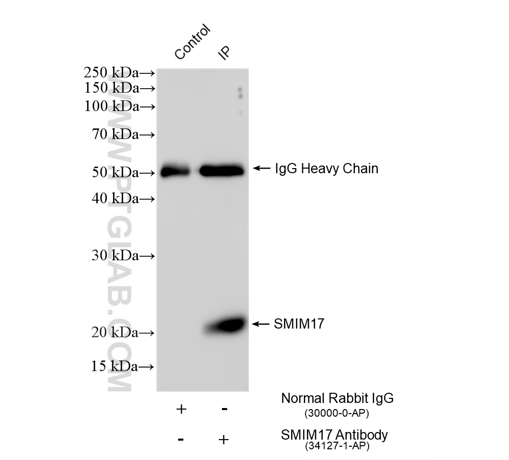 IP experiment of mouse brain using 34127-1-AP IP experiment of mouse brain using 34127-1-AP