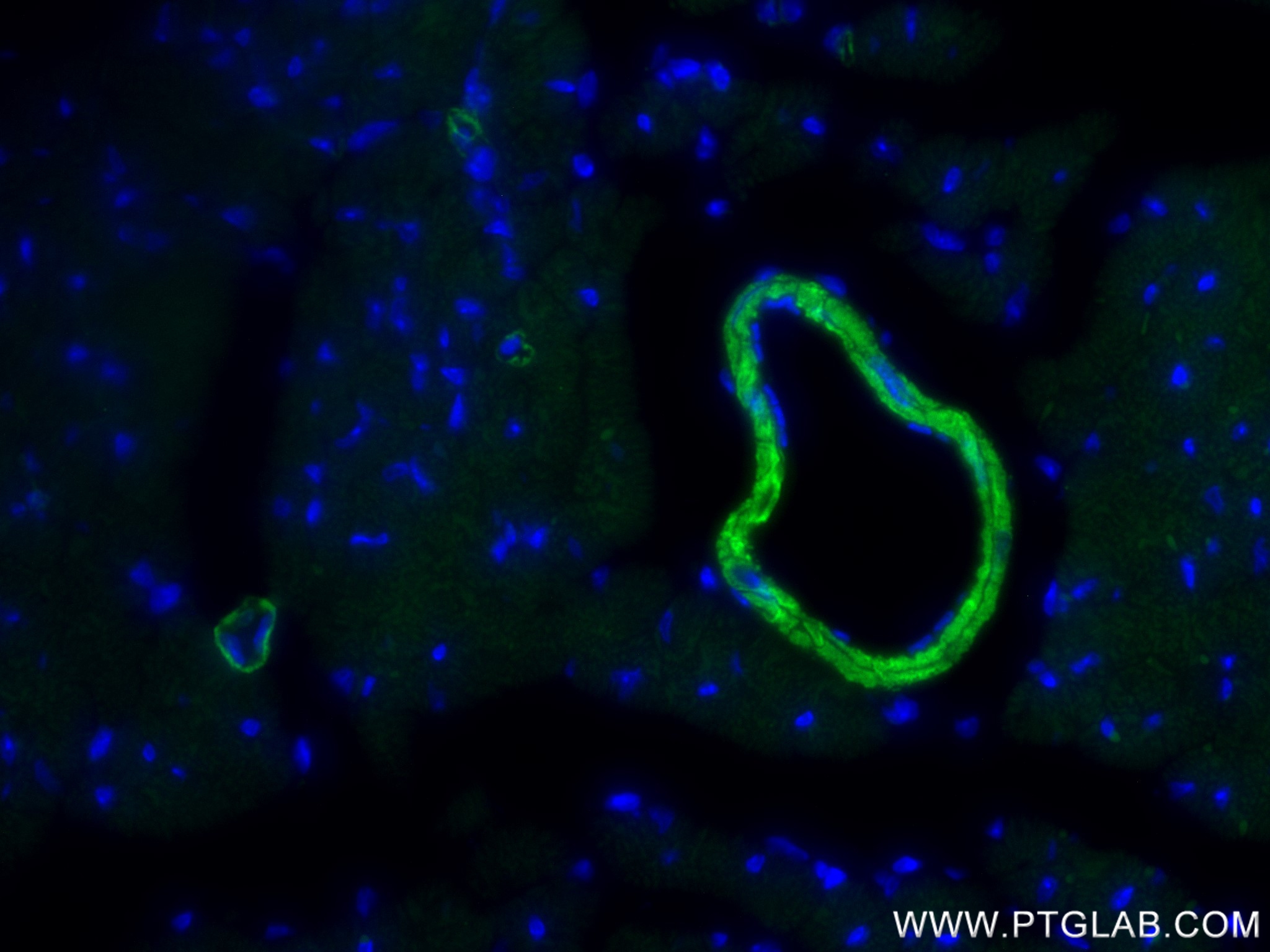 IF Staining of mouse heart using 86654-3-RR (same clone as 86654-3-PBS)