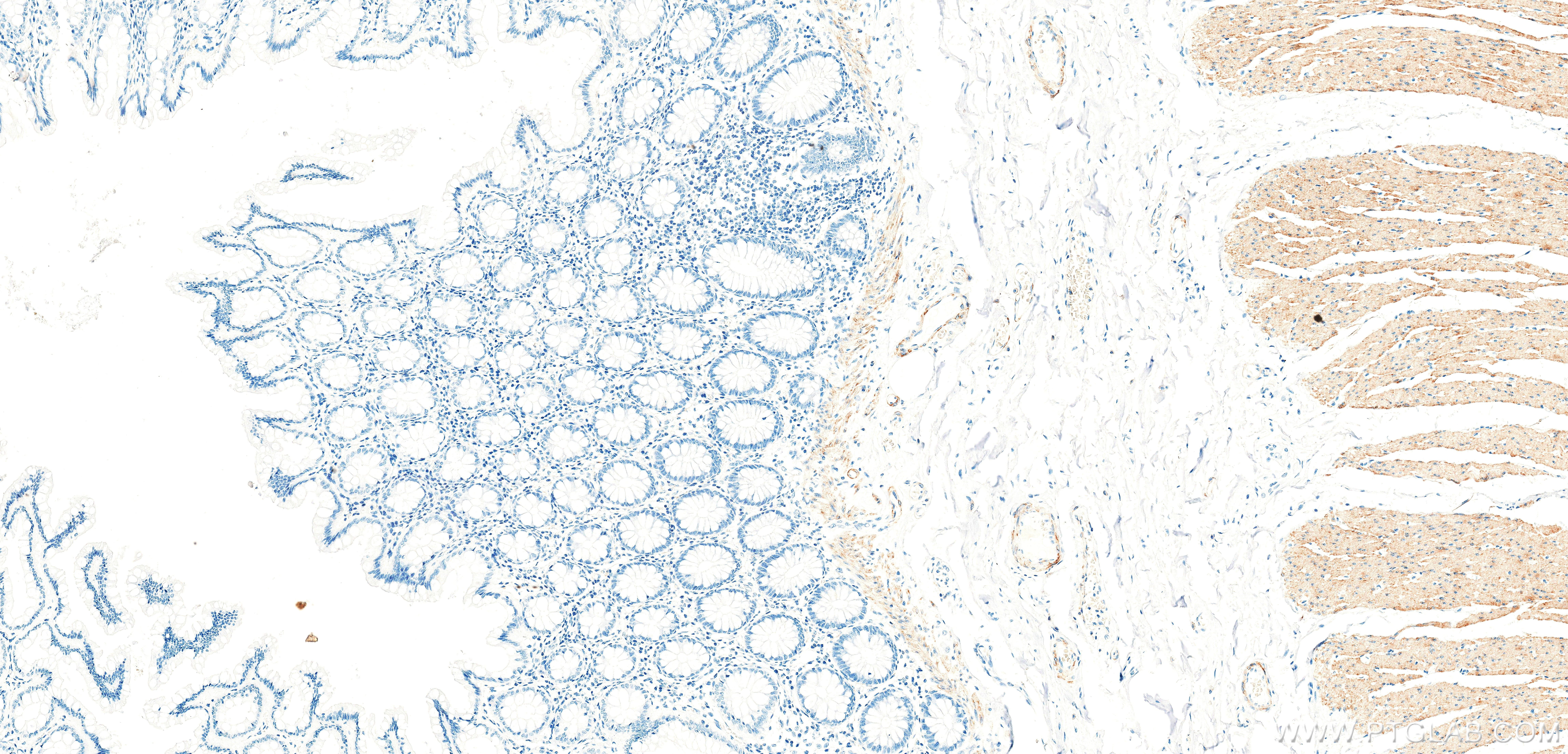 IHC staining of human colon using 86654-3-RR
