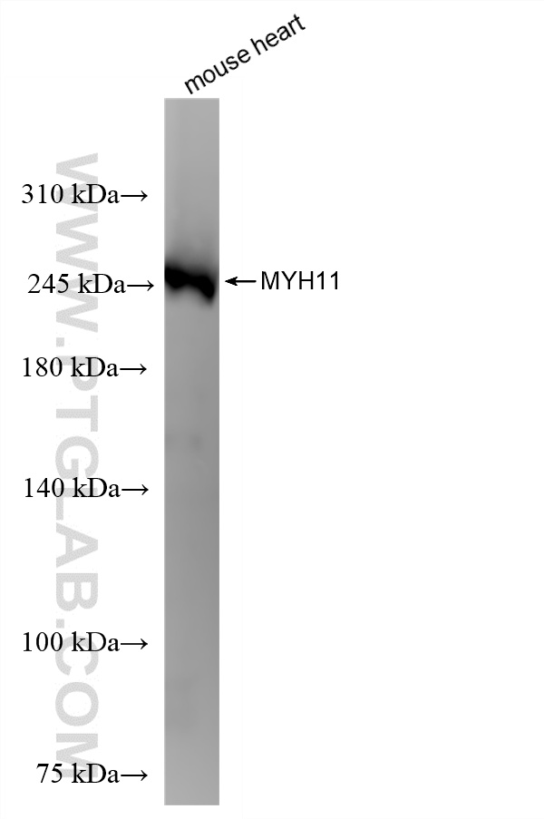 WB analysis of mouse heart using 86654-3-RR