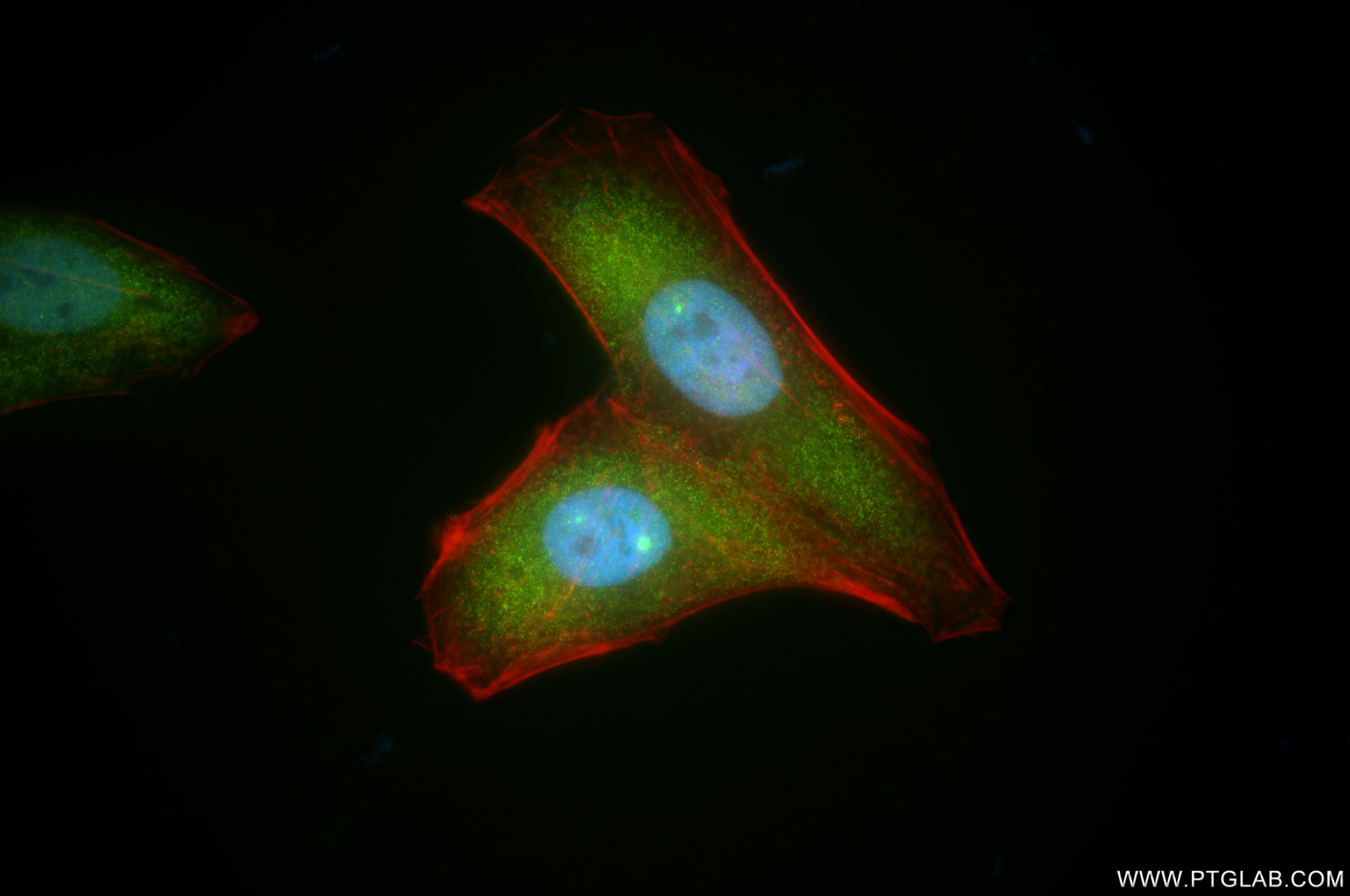 IF Staining of HepG2 using 86668-2-RR IF Staining of HepG2 using 86668-2-RR