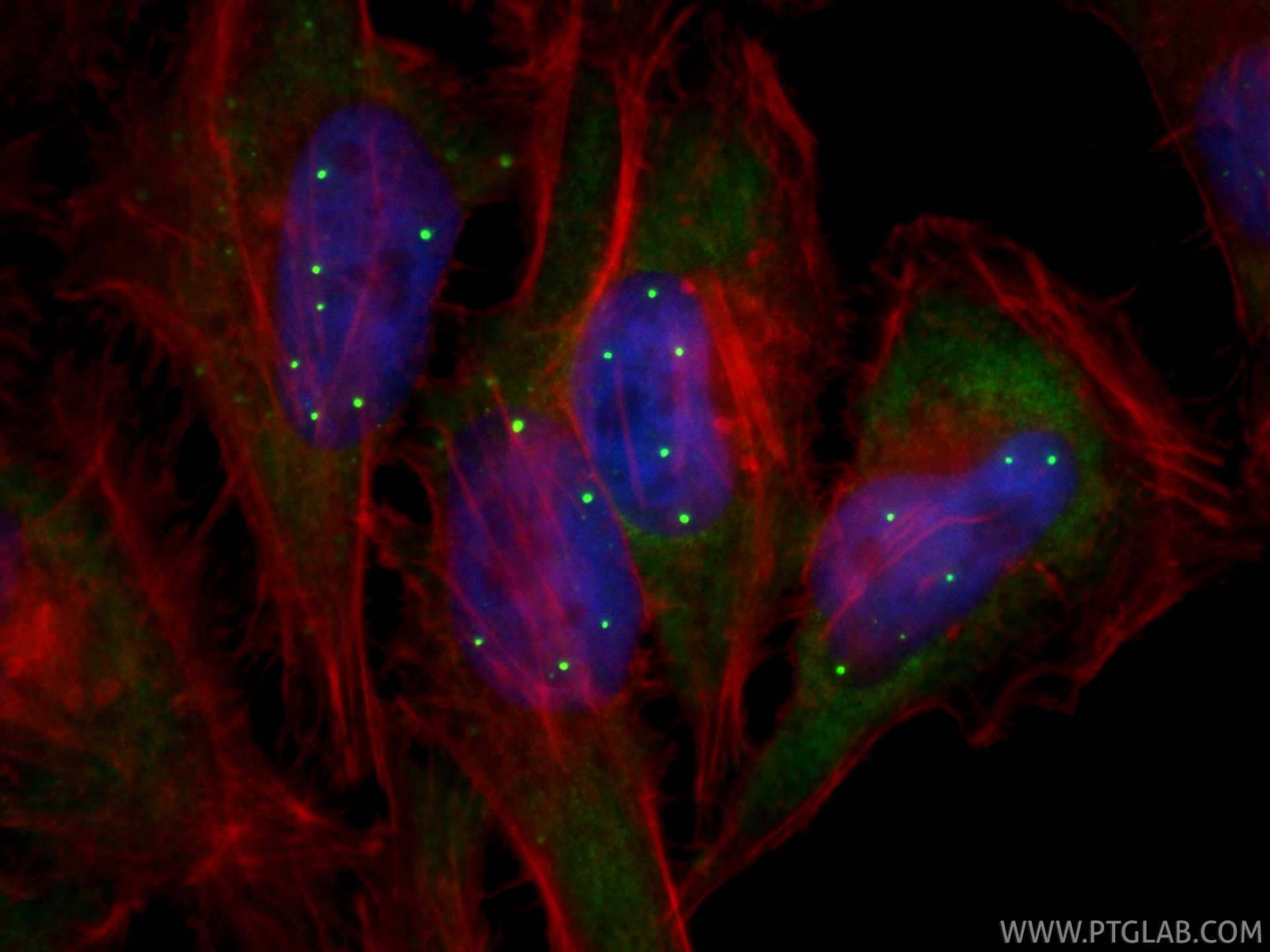 IF Staining of HeLa using 86668-2-RR IF Staining of HeLa using 86668-2-RR