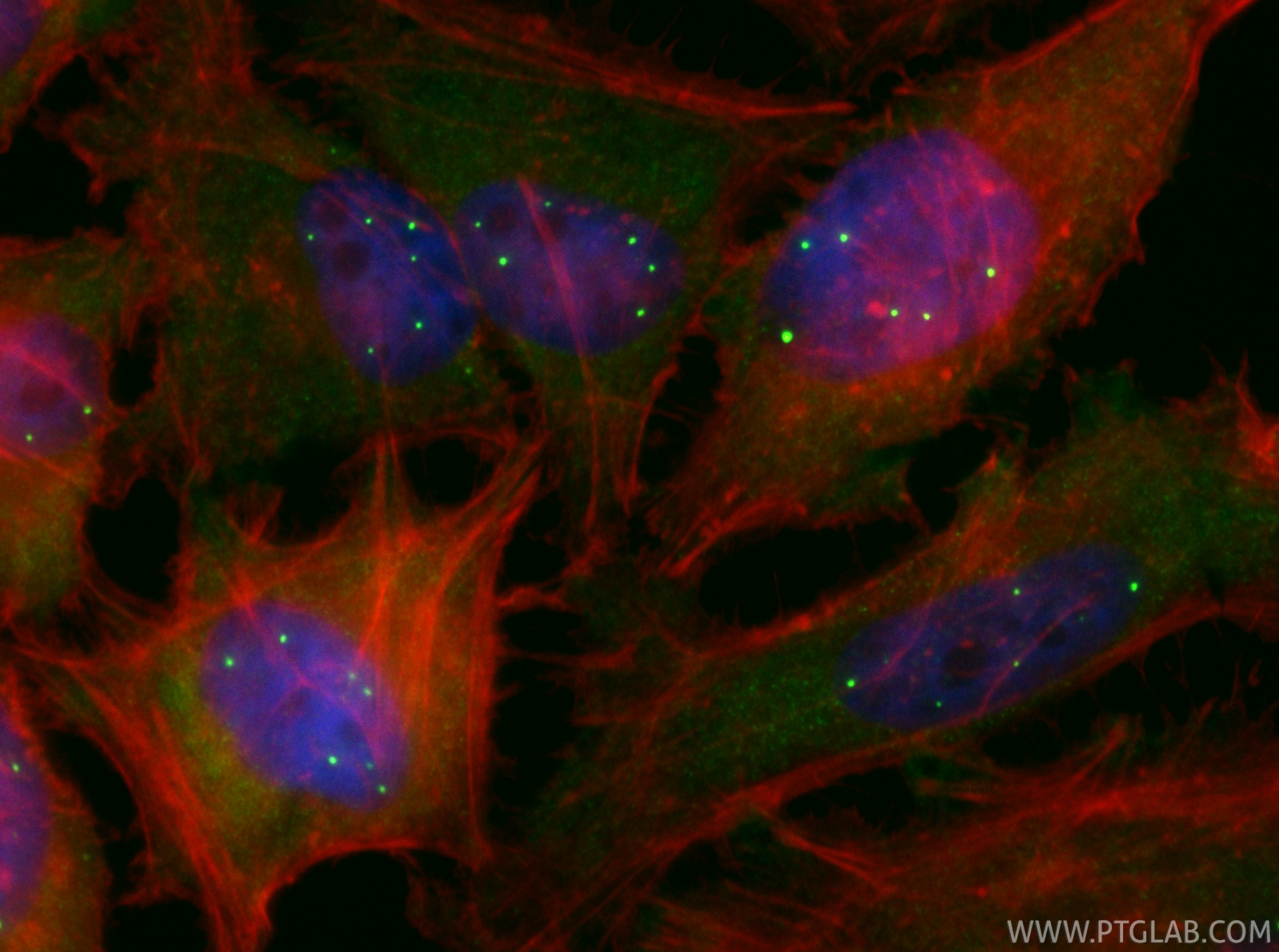 IF Staining of HeLa using CL488-86668-2 IF Staining of HeLa using CL488-86668-2
