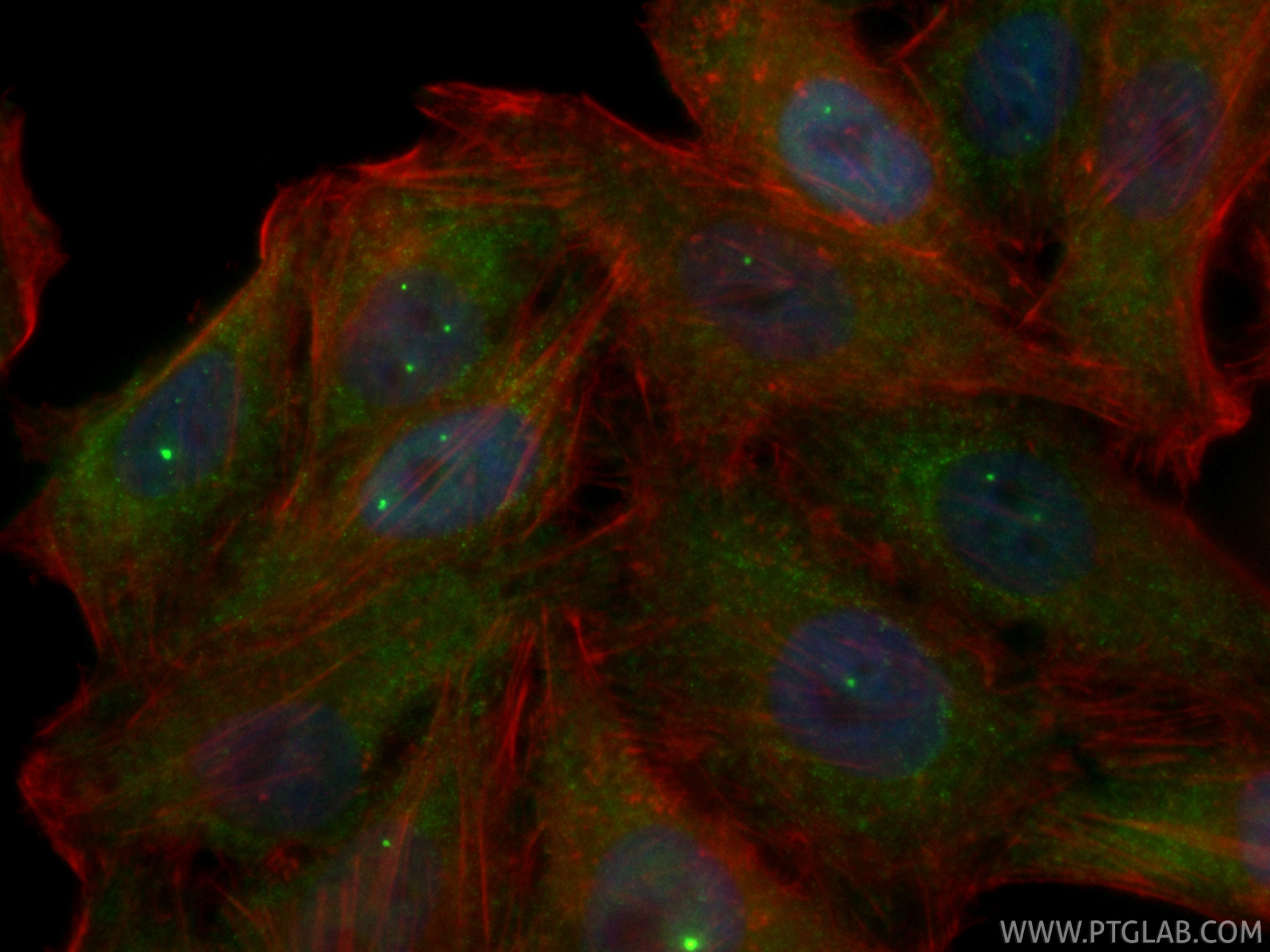 IF Staining of HepG2 using CL488-86668-2 IF Staining of HepG2 using CL488-86668-2