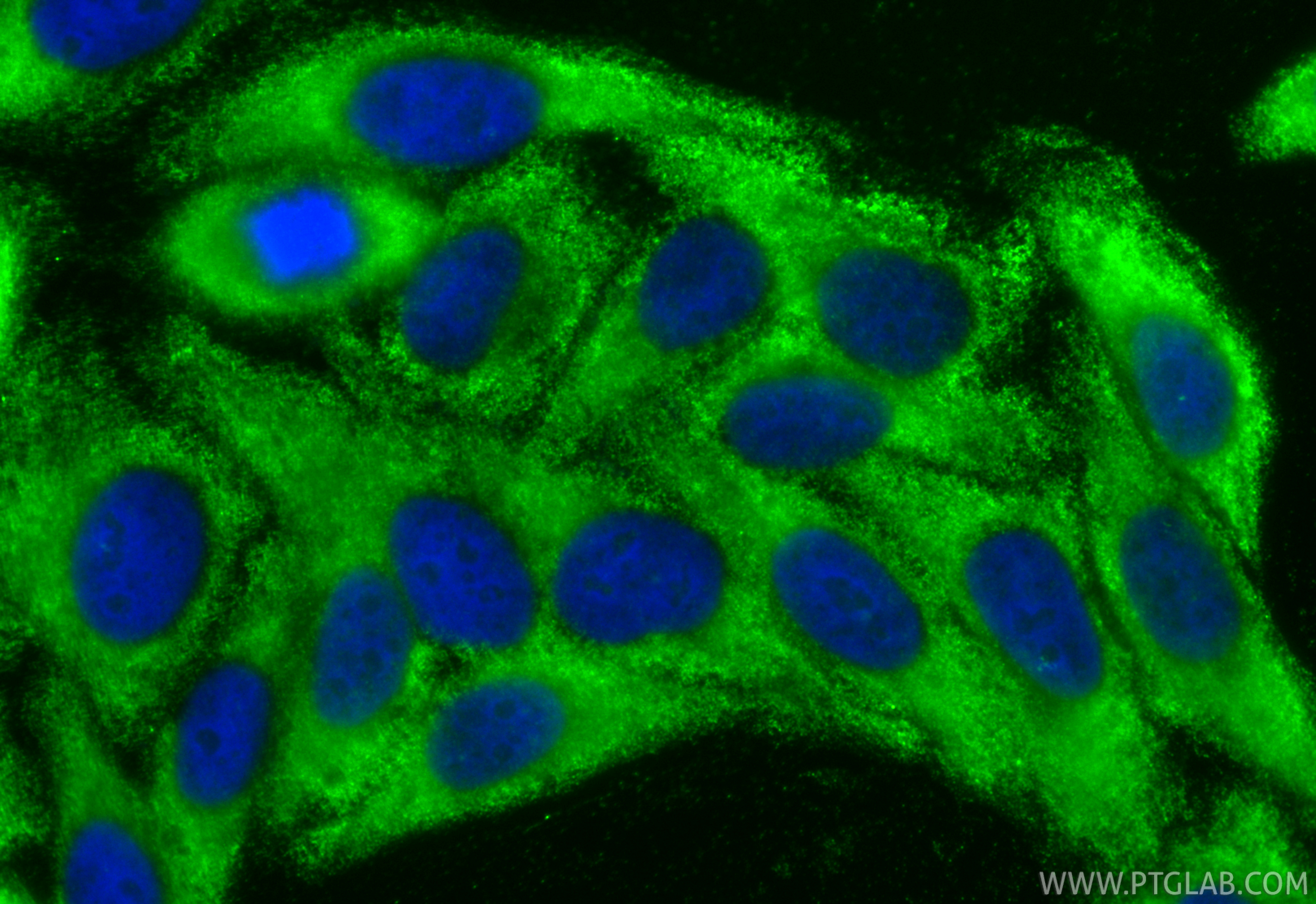Immunofluorescent analysis of (-20°C Ethanol) fixed HepG2 cells using CoraLite® Plus 488 SMN-Exon7 antibody (CL488-60255, Clone: 3A8G11 ) at dilution of 1:200. IF Staining of HepG2 using CL488-60255