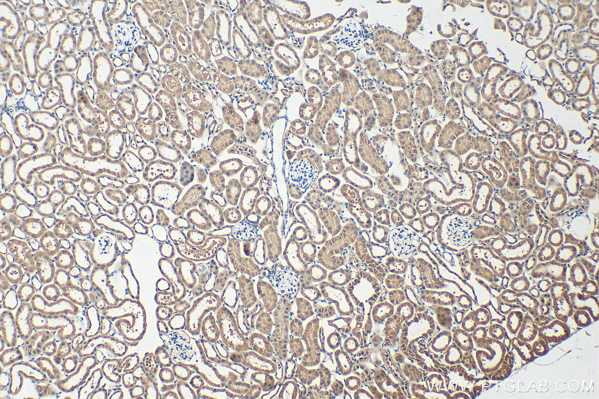 IHC staining of mouse kidney using 20451-1-AP