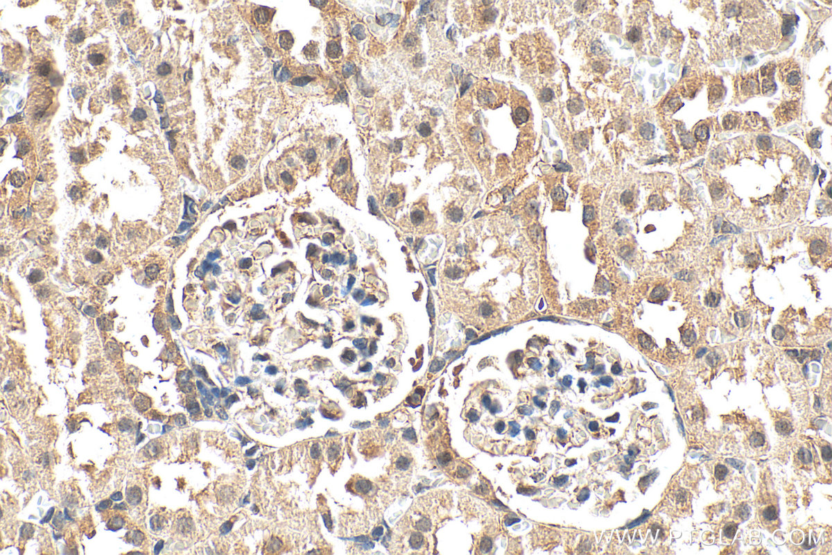 IHC staining of rat kidney using 20451-1-AP